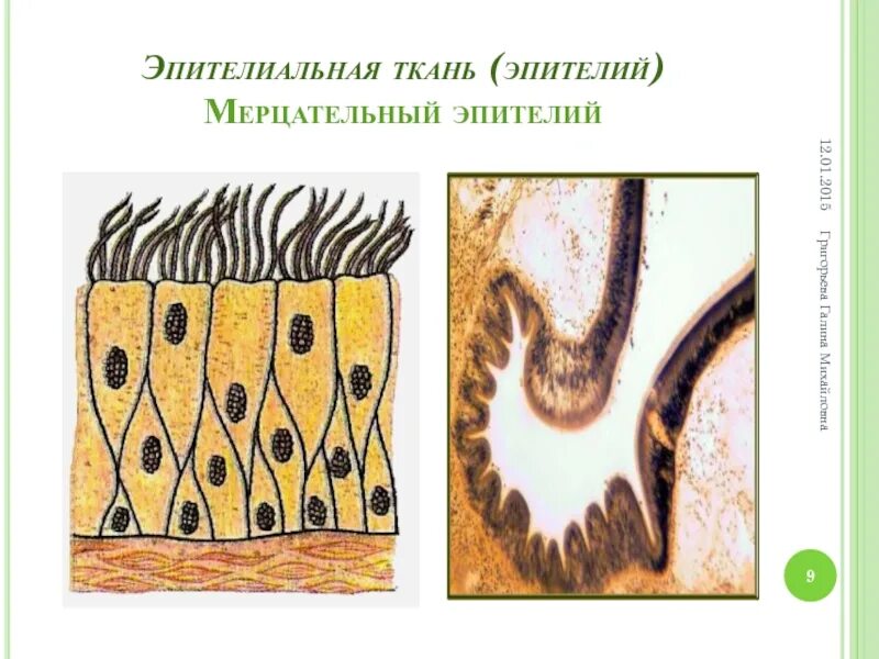 Ткань бывает реснитчатой. Ткань бывает реснитчатой
