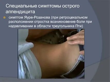 Как определить аппендицит самостоятельно у женщин
