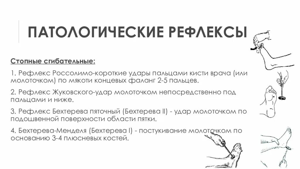 Патологический рефлекс Бехтерева. Патологический рефлекс Россолимо. Патологические сгибательные рефлексы Жуковском. Патологический рефлекс Россолимо на руке.