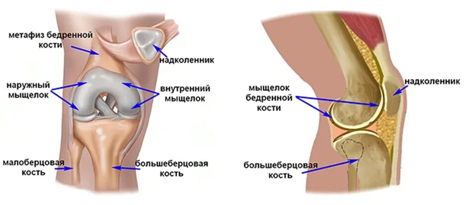 Краевой перелом наружного мыщелка бедренной кости. Латеральный мыщелок бедренной кости в коленном суставе. Импрессионный перелом внутреннего мыщелка бедренной кости. Перелом наружного мыщелка колени.