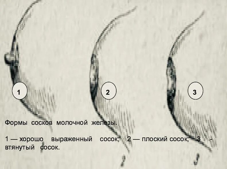Виды сосков примеры. Популярная форма женских сосков. Как выглядит втянутый сосок. Нормальная мужская грудь. Типы языковых сосочков.
