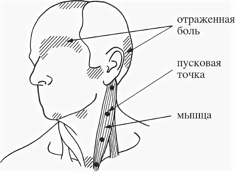 Триггерные точки клэр дэвис амбер дэвис. Дэвис триггерные точки книга. триггерные точки клэр дэвис. триггерные точки девис. девиз триггерные точки.