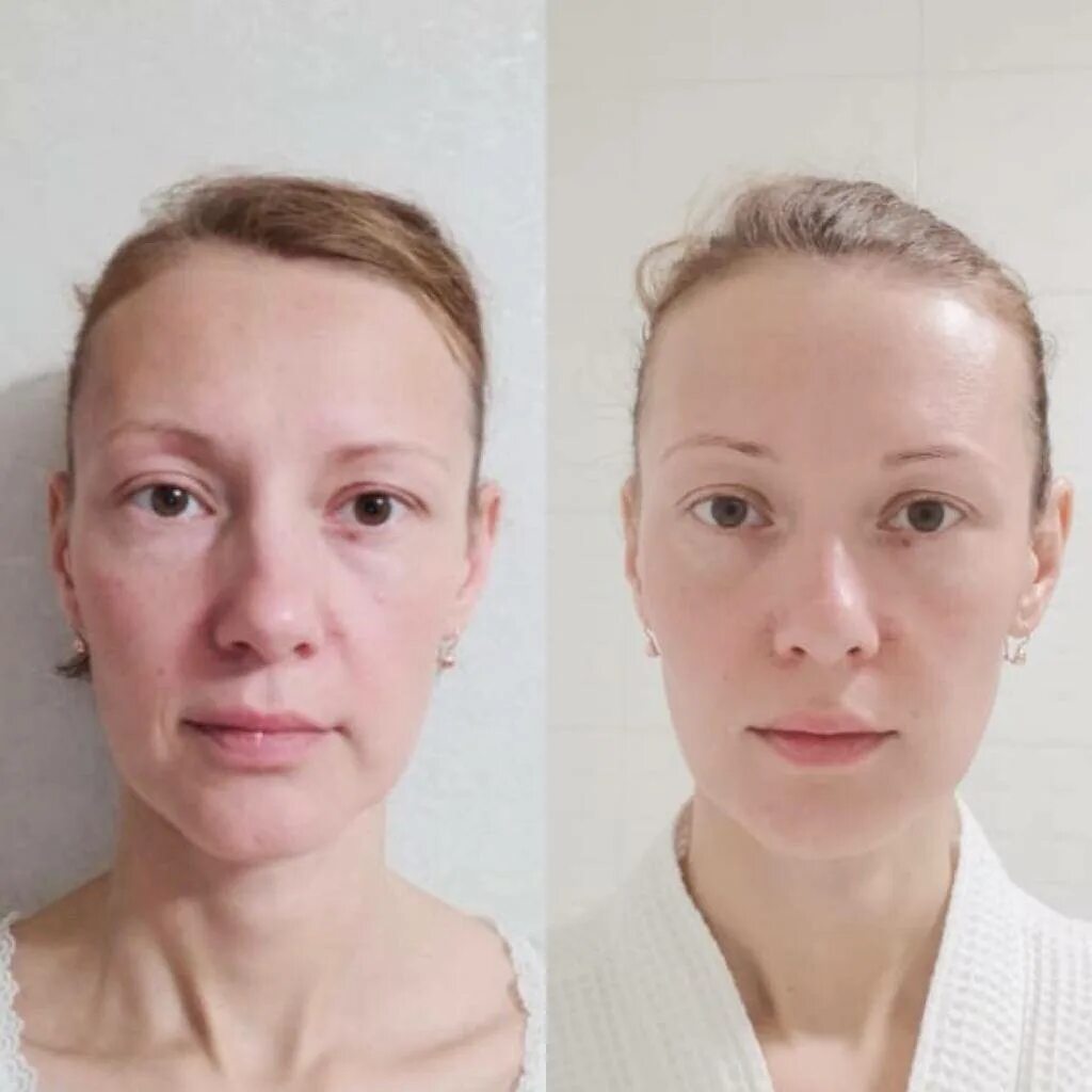Пластический массаж лица фото до и после. Массаж лица до и после. Фейсбилдинг до и после.