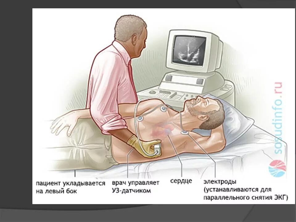 Где можно сделать эхокг. Эхокардиография метод исследования. ультразвуковое исследование сердца - эхокг что это. положение пациента при проведении эхокардиографии. методика проведения эхокардиографии.