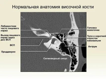 Кт этажи