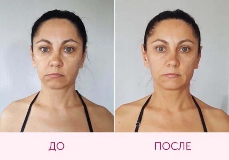 Применение метода до и после