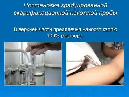 Постановка проб псо