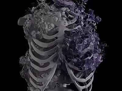 Broken body