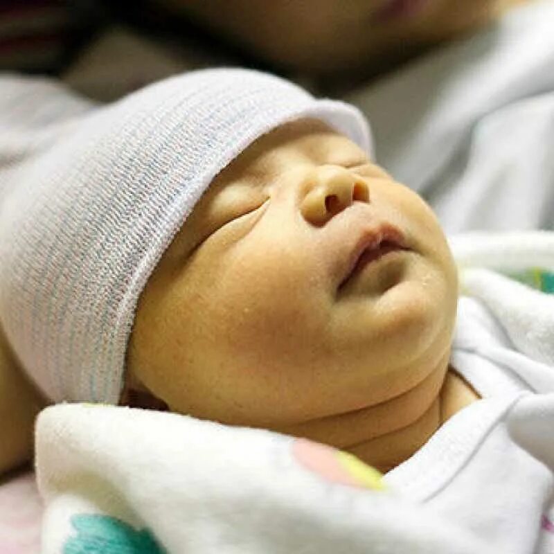 Желтушка у новорожденного. Прегнановая желтуха у новорожденных. Желтуха новорожденных отзывы