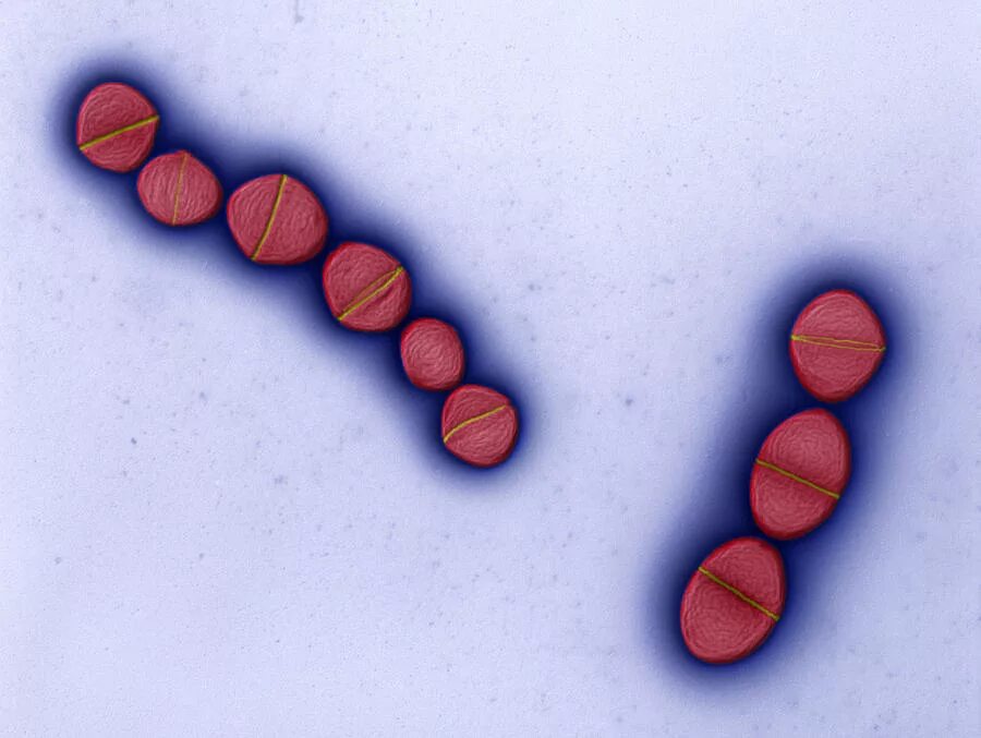 Enterococcus faecalis. Энтерококкус фациалис. enterococcus faecalis микробиология. энтерококки каталаза. энтерококки грамм.