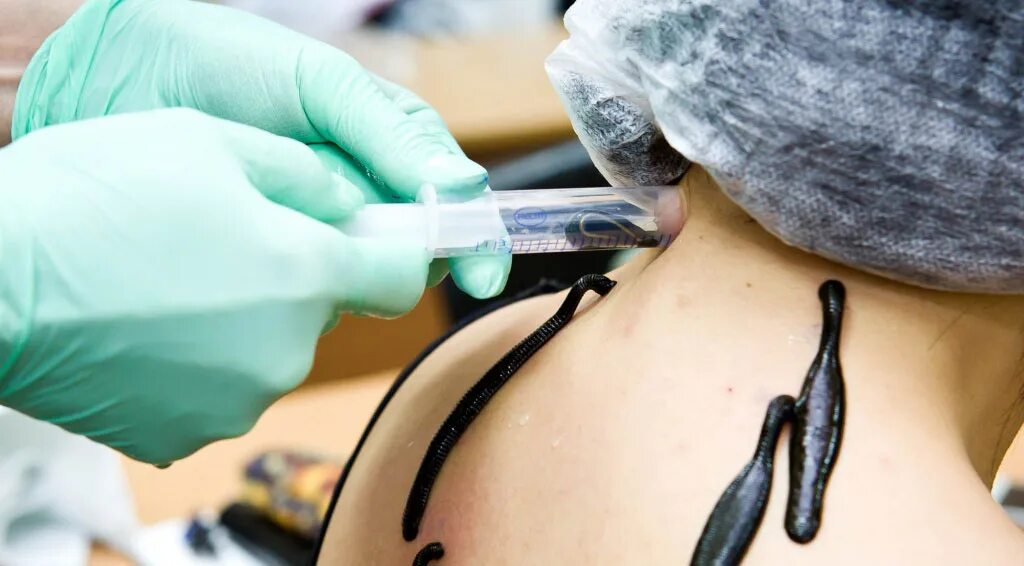 Пиявки картинки прикольные. Гирудотерапия в уфе. Гирудотерапия в уфе. Медицинские пиявки в уфе. Гирудотерапия в уфе.