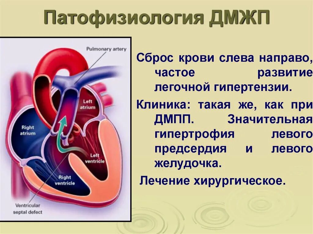 Код мкб дмжп у детей