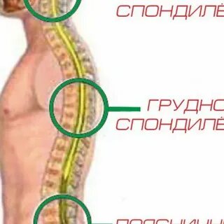 Симптомы грудного спондилеза у женщин