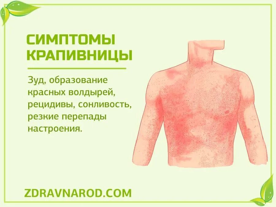 АЛЛЕРГИЯ НА СОЛНЦЕ. Если появилась аллергия на солнце,либо кожная реакция, то Ри