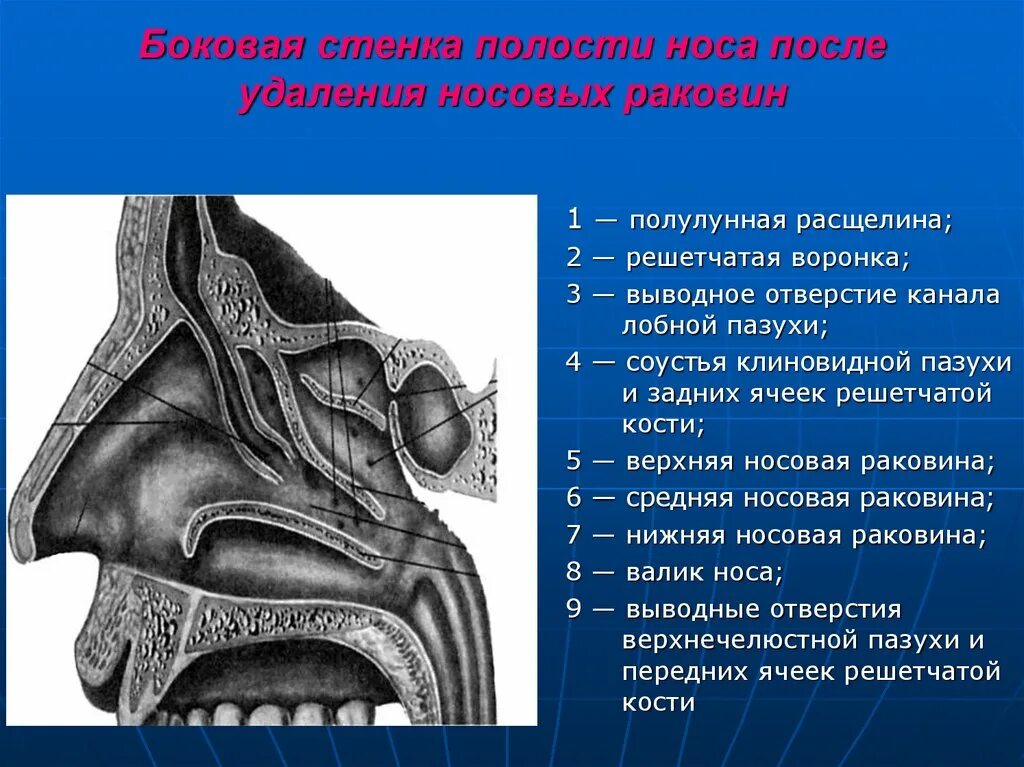 Содержимое в основной пазухе