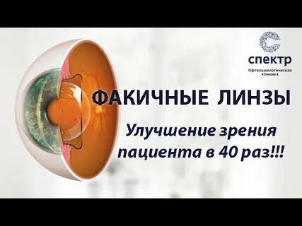 Факичные линзы отзывы