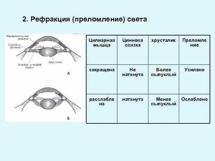 Связка хрусталика глаза функции