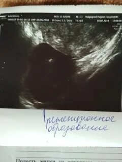Задержка после дюфастона форум