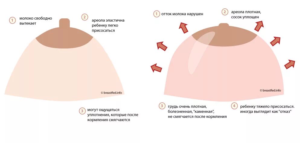 Белеет сосок после кормления