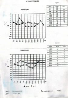 Пройти аудиометрию