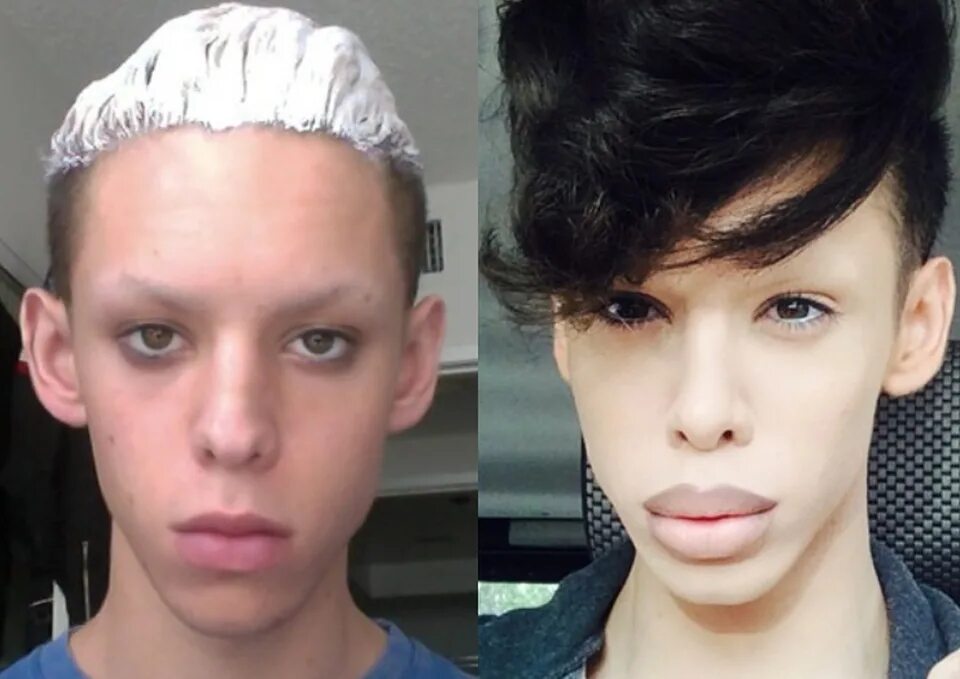 Келсо сантибаньес до и после операции. Парень стал азиатом. Как быть похожим на тему. Кумиры мира. Похожий на кена джимми физерстоун.