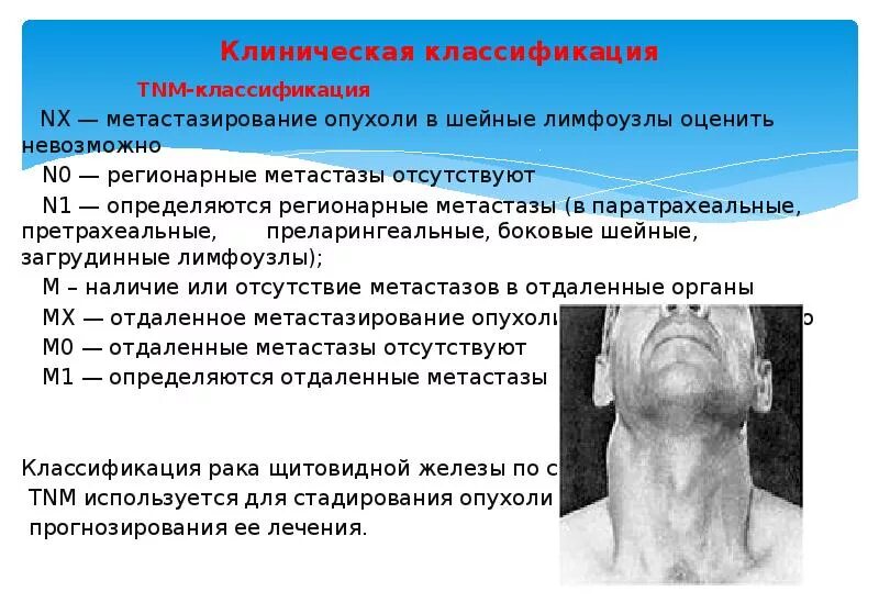 Регионарные метастазы при раке. Метастазы опухоли щитовидной. опухоли щитовидной железы классификация. метастазы в регионарные лимфатические узлы.