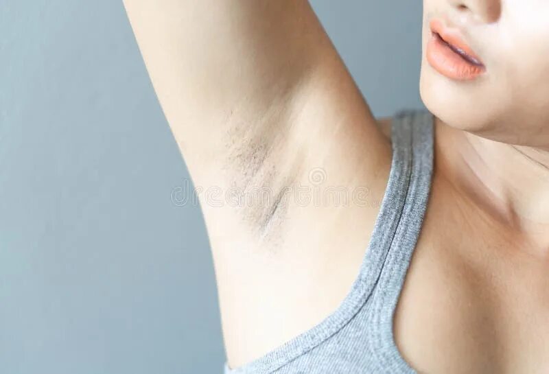 Почему подмышки темные у девушки. Волосы на теле у звезд. Почему подмышки темные у девушки. Тёмные подмышки у женщин. Подмышки тёмные женские.