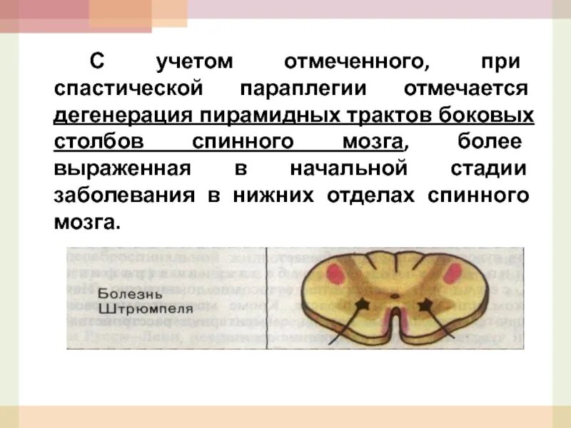 Оливопонтоцеребеллярная дегенерация. Оливопонтоцеребеллярная атрофия. Дегенерации спинного мозга. Поражение бокового столба спинного мозга.