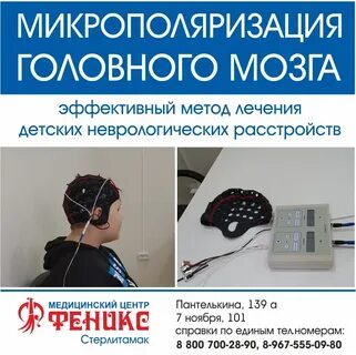 Микрополяризация мозга детям