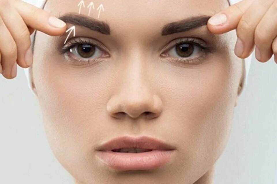 Броулифт. Подтяжка бровей. Лифтинг бровей. Броулифт бровей. Brow lifting