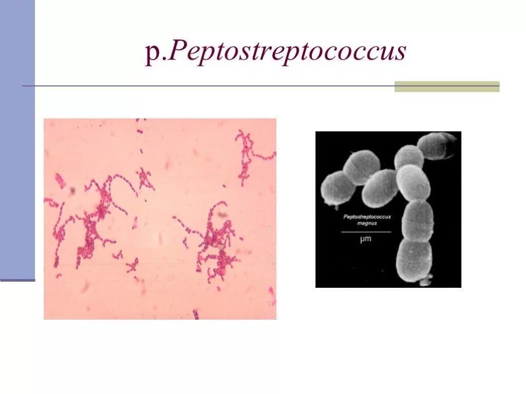 Peptostreptococcus