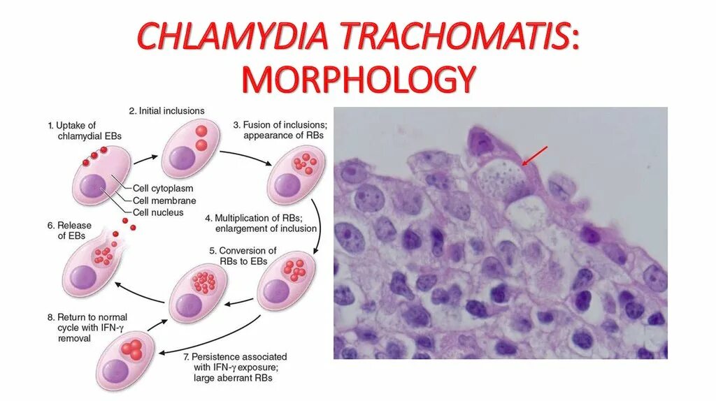 Chlamydia trachomatis. Хламидиоз микроскопия мазка. Урогенитальный хламидиоз микроскопия. Chlamydia trachomatis микроскопия.