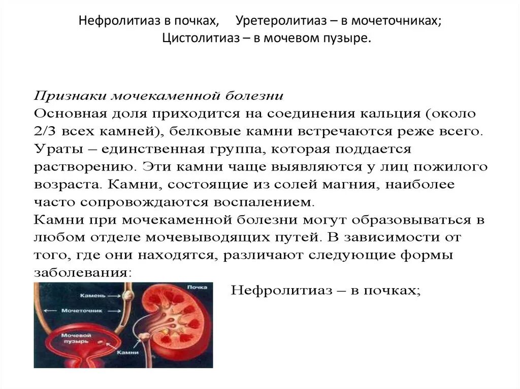 Мочекаменная болезнь симптомы причины меры профилактики. Нефролитиаз клинические проявления. Мочекаменная болезнь (нефролитиаз). Основные симптомы нефролитиаза.