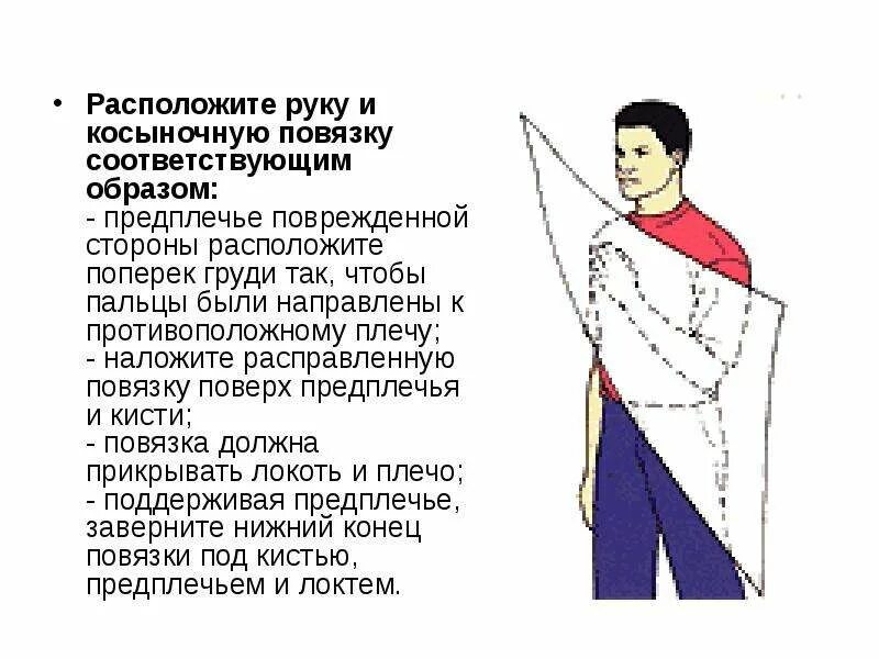 При каких ранениях применяется косыночная повязка. Косыночная повязка на молочную железу. косыночные повязки на предплечье. косыночной повязки на правое предплечье. косыночная повязка на предплечье алгоритм.