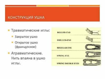 Закрытая игла