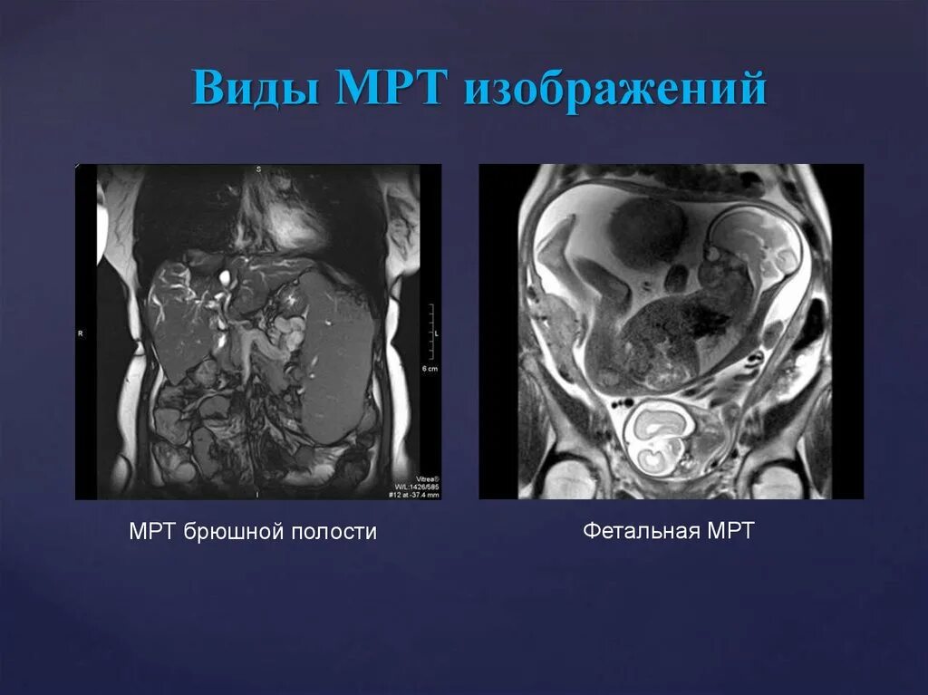 Мрт снимки органов брюшной полости. Мрт органов брюшной полости норма. Кт и мрт органов брюшной полости. Компьютерная томография (кт) брюшной полости. Разница кт и кт с контрастом