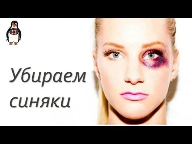Как быстро убрать синяк с лица. Как быстро избавиться от синяка. как быстро убрать синяк под глазом. как быстро избавиться от синяков на лице.