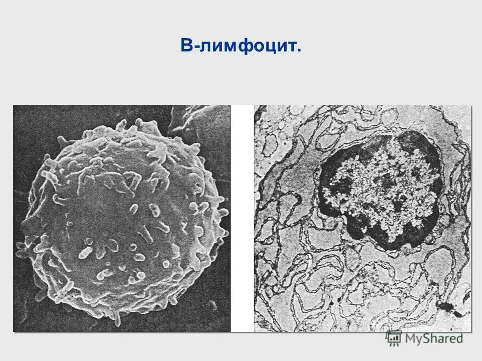 Т и в лимфоциты это. B лимфоциты строение. т и в лимфоциты микрофотография. т лимфоциты под микроскопом. лимфоциты строение.