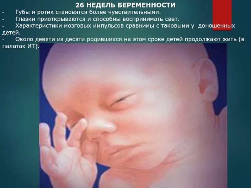 Ребенок на 23-24 недели беременности. 24 неделя беременности как выглядит. 24 акушерская неделя беременности. Плод на 23 неделе беременности. 23-24 недели беременности.