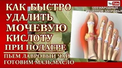 Обезболивающая мазь при подагре