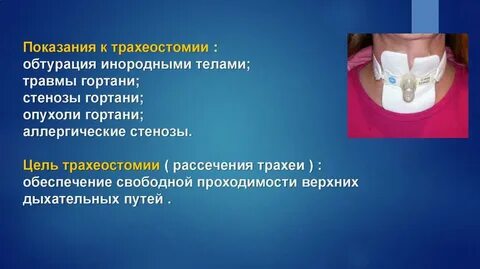 Повреждение гортани