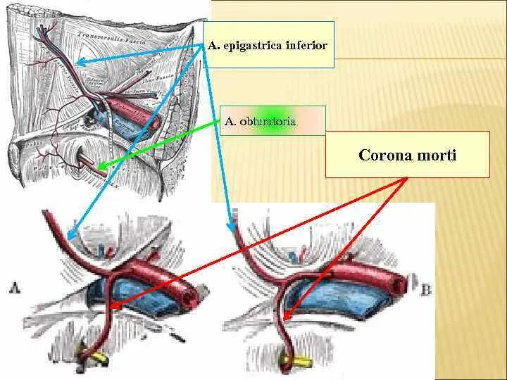 Артерии genshin impact. Нижняя надчревная артерия (a. epigastrica inferior):. arteria epigastrica inferior хирургия. нижняя надчревная артерия анастомоз. лобковая ветвь нижней надчревной артерии.