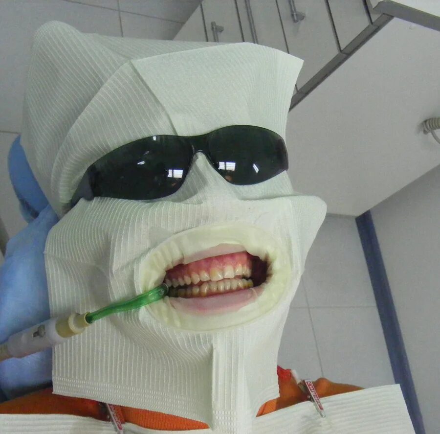 Стоматология приколы. Зубы прикол видео. Зубы прикол видео. Зубной. Зубы прикол видео.