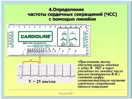 Измерение чсс