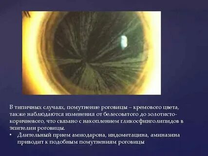 Характерный случай