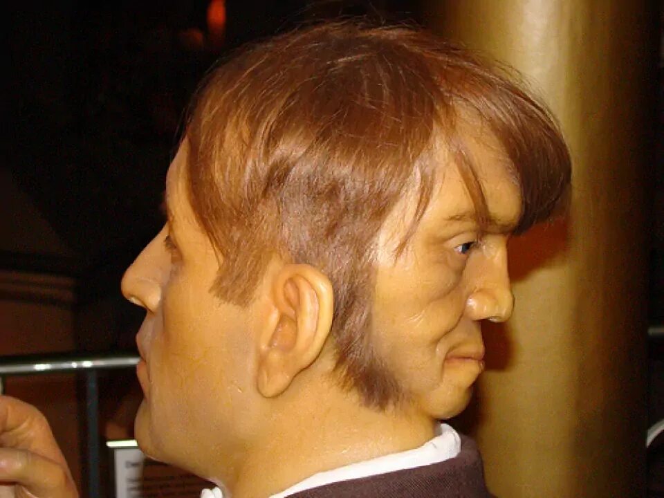 Нечеткий овал лица. Дополнительное лицо. Девушка с проблемной кожей. Пилинг браун. Тональный крем до и после.