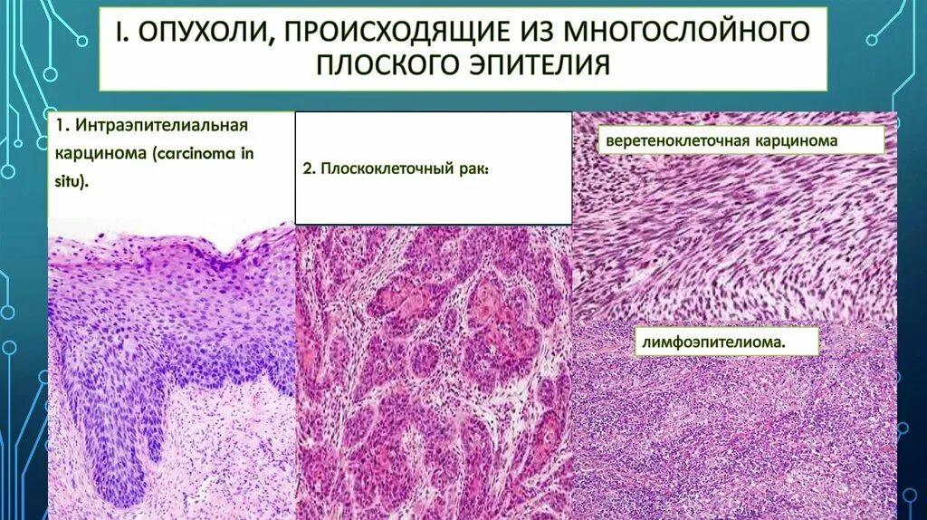 Гистологического строения опухоли. Гистологического строения опухоли