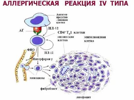 Формы аллергических реакций iv типа