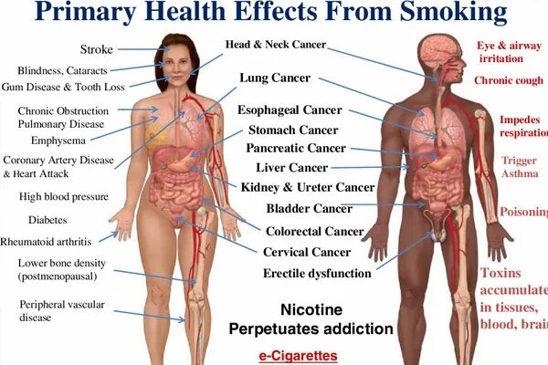 Health risks. Healthy risks of smoking.