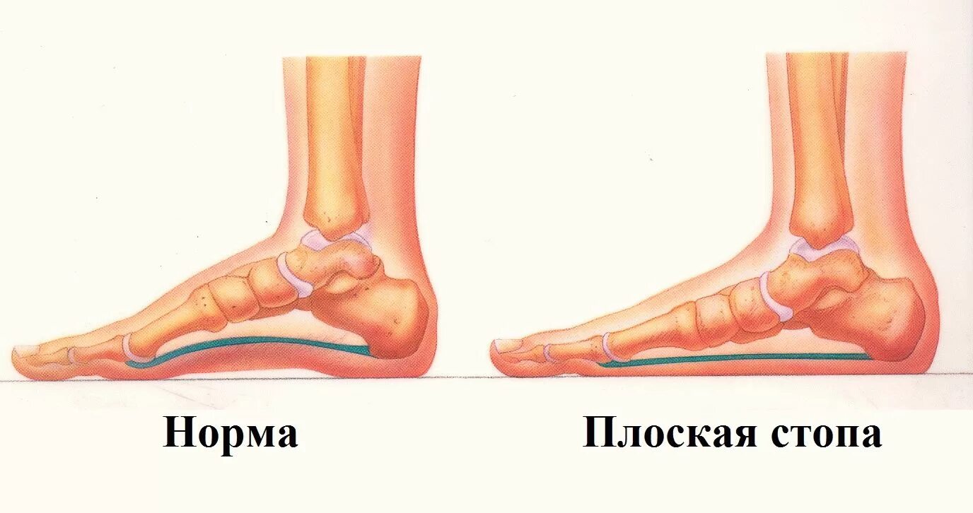 1 3 стопы